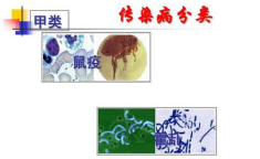 甲类传染病是指什么?,强制管理下的健康防线